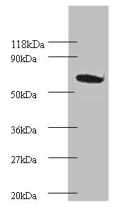 Western blot  | All lanes: Proteasome subunit beta type-4 Antibody at 2μg/ml + EC109 whole cell lysate  | Secondary  | Goat polyclonal to rabbit IgG at 1/15000 dilution  | Predicted band size: 30 kDa  | Observed band size: 75 kDaRabbit anti-Human PSMB4 Polyclonal Antibody