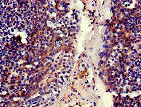 Immunohistochemistry of paraffin-embedded human tonsil tissue using MELTF Antibody at dilution of 1:100