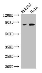 Western Blot  | Positive WB detected in: HEK293 whole cell lysate, Hela whole cell lysate  | All lanes: MELTF antibody at 3µg/ml  | Secondary  | Goat polyclonal to rabbit IgG at 1/50000 dilution  | Predicted band size: 81, 33 kDa  | Observed band size: 81 kDa