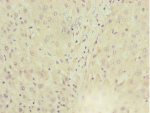 Immunohistochemistry of paraffin-embedded human liver tissue using MGAT1 Antibody at dilution of 1:100