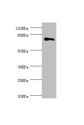 Western blot  | All lanes: MGAT1 antibody at 1.18μg/ml + 293T whole cell lysate  | Secondary  | Goat polyclonal to rabbit IgG at 1/10000 dilution  | Predicted band size: 75 kDa  | Observed band size: 75 kDa
