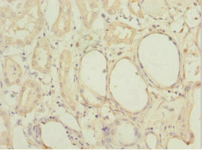Immunohistochemistry of paraffin-embedded human kidney tissue using MGLL Antibody at dilution of 1:100