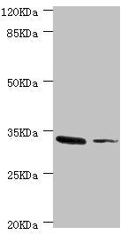 Western blot | All lanes: MGLL antibody at 2.37μg/ml | Lane 1: Mouse liver tissue | Lane 2: HT-29 whole cell lysate | Secondary | Goat polyclonal to rabbit IgG at 1/10000 dilution | Predicted band size: 34, 32 kDa | Observed band size: 34 kDa