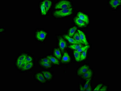 Immunofluorescence staining of HepG2 cells with MIP Antibody at 1:66, counter-stained with DAPI. The cells were fixed in 4% formaldehyde, permeabilized using 0.2% Triton X-100 and blocked in 10% normal Goat Serum. The cells were then incubated with the antibody overnight at 4°C. The secondary antibody was Alexa Fluor 488-congugated AffiniPure Goat Anti-Rabbit IgG(H+L).