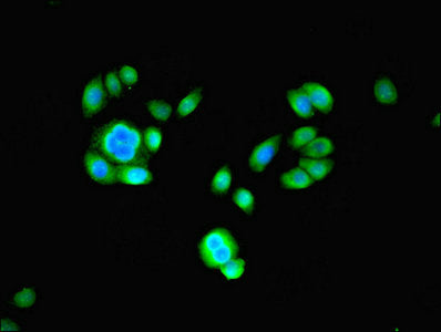 Immunofluorescent analysis of PC-3 cells using PSMB2 Antibody at dilution of 1:100 and Alexa Fluor 488-congugated AffiniPure Goat Anti-Rabbit IgG(H+L)Rabbit anti-Human PSMB2 Polyclonal Antibody