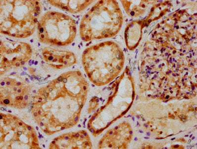 IHC image of PSMB2 Antibody diluted at 1:500 and staining in paraffin-embedded human kidney tissue performed on a Leica BondTM system. After dewaxing and hydration, antigen retrieval was mediated by high pressure in a citrate buffer (pH 6.0). Section was blocked with 10% normal goat serum 30min at RT. Then primary antibody (1% BSA) was incubated at 4°C overnight. The primary is detected by a biotinylated secondary antibody and visualized using an HRP conjugated SP system.Rabbit anti-Human PSMB2 Polyclonal Antibody