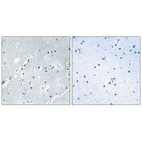 Immunohistochemistry analysis of paraffin-embedded human brain tissue using Histone H2B antibody.Rabbit anti-Human HIST1H2BH Polyclonal Antibody