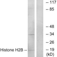 Western blot analysis of extracts from A549 cells, using Histone H2B antibody.Rabbit anti-Human HIST1H2BH Polyclonal Antibody