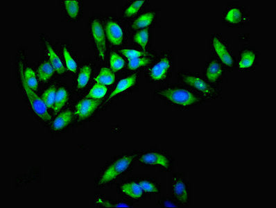 Immunofluorescent analysis of Hela cells using MYH9 Antibody at dilution of 1:100 and Alexa Fluor 488-congugated AffiniPure Goat Anti-Rabbit IgG(H+L)Rabbit anti-Human MYH9 Polyclonal Antibody