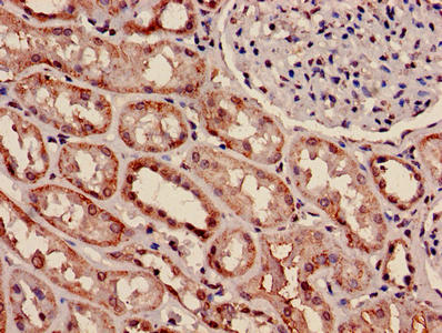 Immunohistochemistry of paraffin-embedded human kidney tissue using the antibody at dilution of 1:100Rabbit anti-Human MYH9 Polyclonal Antibody