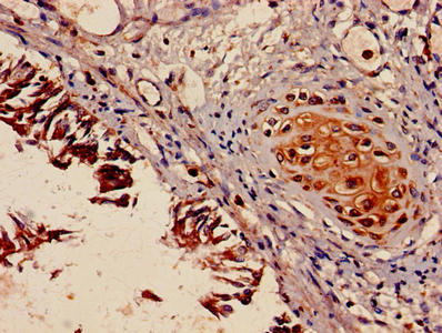 Immunohistochemistry of paraffin-embedded human lung tissue using MYH9 Antibody at dilution of 1:100Rabbit anti-Human MYH9 Polyclonal Antibody