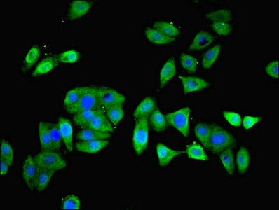 Immunofluorescent analysis of HepG2 cells using PFDN5 Antibody at dilution of 1:100 and Alexa Fluor 488-congugated AffiniPure Goat Anti-Rabbit IgG(H+L)Rabbit anti-Human PFDN5 Polyclonal Antibody
