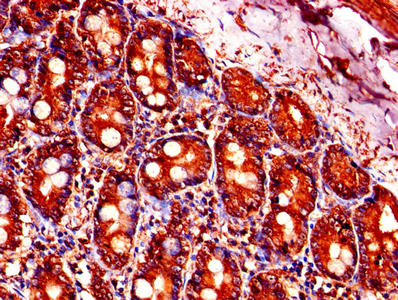 Immunohistochemistry of paraffin-embedded human small intestine tissue using PFDN5 Antibody at dilution of 1:100Rabbit anti-Human PFDN5 Polyclonal Antibody