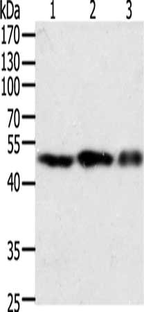 Gel: 10%SDS-PAGE, Lysate: 40 μg, Lane 1-3: NIH/3T3 cells, 293T cells, Jurkat cells, Primary antibody: F7 Antibody(F7 Antibody) at dilution 1/400, Secondary antibody: Goat anti rabbit IgG at 1/8000 dilution, Exposure time: 30 seconds