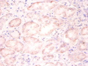 Immunohistochemistry of paraffin-embedded human kidney tissue using H3F3A Antibody at dilution of 1:100Rabbit anti-Human H3F3A Polyclonal Antibody