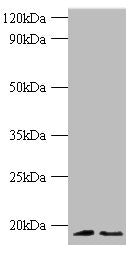 Western blot | All lanes: Histone H3.3 antibody at 2μg/ml | Lane 1: 293T whole cell lysate | Lane 2: EC109 whlole cell lysate | Secondary | Goat polyclonal to rabbit IgG at 1/1000 dilution | Predicted band size: 15 kDa | Observed band size: 15 kDaRabbit anti-Human H3F3A Polyclonal Antibody