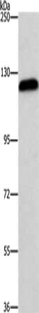 Gel: 6%SDS-PAGE, Lysate: 40 μg, Lane: Hela cells, Primary antibody: AGAP2 Antibody(AGAP2 Antibody) at dilution 1/700, Secondary antibody: Goat anti rabbit IgG at 1/8000 dilution, Exposure time: 40 seconds