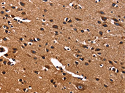 The image on the left is immunohistochemistry of paraffin-embedded Human brain  tissue using PHB Antibody(PHB Antibody) at dilution 1/40, on the right is treated with fusion protein. (Original magnification: ×200)Rabbit anti-Human PHB Polyclonal Antibody