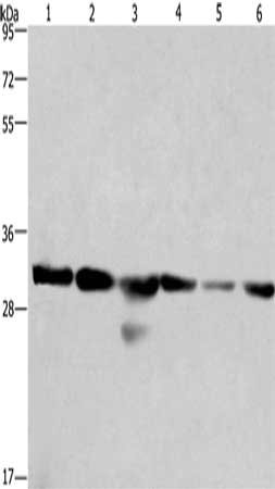 Gel: 10%SDS-PAGE, Lysate: 40 μg, Lane 1-6: 293T cells, A549 cells, human hepatocellular carcinoma tissue, PC3 cells, hela cells, mouse heart tissue, Primary antibody: PHB Antibody(PHB Antibody) at dilution 1/500, Secondary antibody: Goat anti rabbit IgG at 1/8000 dilution, Exposure time: 15 secondsRabbit anti-Human PHB Polyclonal Antibody