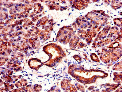 IHC image of YWHAZ Antibody diluted at 1:1000 and staining in paraffin-embedded human pancreatic tissue performed on a Leica BondTM system. After dewaxing and hydration, antigen retrieval was mediated by high pressure in a citrate buffer (pH 6.0). Section was blocked with 10% normal goat serum 30min at RT. Then primary antibody (1% BSA) was incubated at 4°C overnight. The primary is detected by a biotinylated secondary antibody and visualized using an HRP conjugated SP system.Rabbit anti-Human YWHAZ Polyclonal Antibody