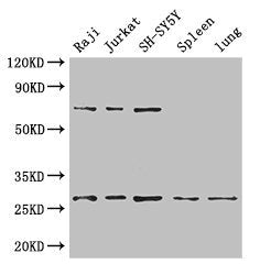 Western Blot  | Positive WB detected in: Raji whole cell lysate, Jurkat whole cell lysate, SH-SY5Y whole cell lysate, Mouse spleen tissue, Mouse lung tissue  | All lanes: YWHAZ antibody at 3.4µg/ml  | Secondary  | Goat polyclonal to rabbit IgG at 1/50000 dilution  | Predicted band size: 28, 20 kDa  | Observed band size: 28, 70 kDaRabbit anti-Human YWHAZ Polyclonal Antibody