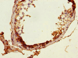 Immunohistochemistry of paraffin-embedded human testis tissue using MLF1 Antibody at dilution of 1:100Rabbit anti-Human MLF1 Polyclonal Antibody