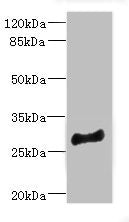 Western blot | All lanes: MLF1 antibody at 4.05μg/ml + Mouse brain tissue | Secondary | Goat polyclonal to rabbit IgG at 1/10000 dilution | Predicted band size: 31, 24, 34, 28, 30 kDa | Observed band size: 31 kDaRabbit anti-Human MLF1 Polyclonal Antibody