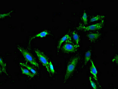 Immunofluorescent analysis of Hela cells using MLPH Antibody at dilution of 1:100 and Alexa Fluor 488-congugated AffiniPure Goat Anti-Rabbit IgG(H+L)Rabbit anti-Human MLPH Polyclonal Antibody