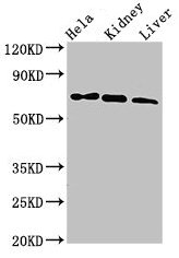 Western Blot  | Positive WB detected in: Hela whole cell lysate, Mouse kidney tissue, Mouse liver tissue  | All lanes: MLPH antibody at 3µg/ml  | Secondary  | Goat polyclonal to rabbit IgG at 1/50000 dilution  | Predicted band size: 66, 63, 53, 61, 51 kDa  | Observed band size: 66 kDaRabbit anti-Human MLPH Polyclonal Antibody