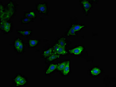 Immunofluorescent analysis of HepG2 cells using MLYCD Antibody at dilution of 1:100 and Alexa Fluor 488-congugated AffiniPure Goat Anti-Rabbit IgG(H+L)Rabbit anti-Human MLYCD Polyclonal Antibody