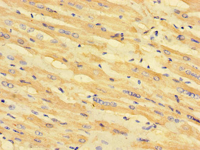 Immunohistochemistry of paraffin-embedded human heart tissue using MLYCD Antibody at dilution of 1:100Rabbit anti-Human MLYCD Polyclonal Antibody