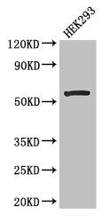 Western Blot  | Positive WB detected in: HEK293 whole cell lysate  | All lanes: MLYCD antibody at 2.7µg/ml  | Secondary  | Goat polyclonal to rabbit IgG at 1/50000 dilution  | Predicted band size: 56, 51 kDa  | Observed band size: 56 kDa