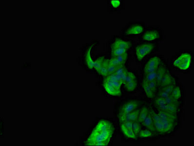 Immunofluorescent analysis of MCF-7 cells using MNDA Antibody at dilution of 1:100 and Alexa Fluor 488-congugated AffiniPure Goat Anti-Rabbit IgG(H+L)Rabbit anti-Human MNDA Polyclonal Antibody
