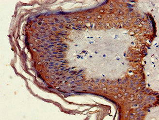 Immunohistochemistry of paraffin-embedded human skin tissue using MNDA Antibody at dilution of 1:100Rabbit anti-Human MNDA Polyclonal Antibody
