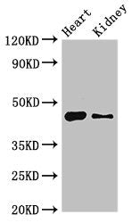 Western Blot | Positive WB detected in: Mouse heart tissue, Mouse kidney tissue | All lanes: MNDA antibody at 4μg/ml | Secondary | Goat polyclonal to rabbit IgG at 1/50000 dilution | Predicted band size: 46 kDa | Observed band size: 46 kDa