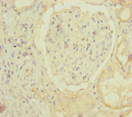 Immunohistochemistry of paraffin-embedded human kidney tissue using MOCS2 Antibody at dilution of 1:100Rabbit anti-Human MOCS2 Polyclonal Antibody