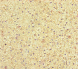 Immunohistochemistry of paraffin-embedded human adrenal gland tissue using MOCS2 Antibody at dilution of 1:100Rabbit anti-Human MOCS2 Polyclonal Antibody