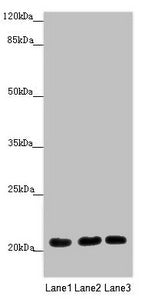 Western blot | All lanes: MOCS2 antibody at 1.68 μg/ml | Lane 1: A549 whole cell lysate | Lane 2: HepG2 whole cell lysate | Lane 3: Jurkat whole cell lysate | Secondary | Goat polyclonal to rabbit IgG at 1/10000 dilution | Predicted band size: 21 kDa | Observed band size: 21 kDaRabbit anti-Human MOCS2 Polyclonal Antibody