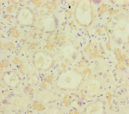 Immunohistochemistry of paraffin-embedded human kidney tissue using MOCS2 Antibody at dilution of 1:100Rabbit anti-Human MOCS2 Polyclonal Antibody