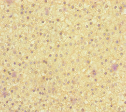 Immunohistochemistry of paraffin-embedded human adrenal gland tissue using MOCS2 Antibody at dilution of 1:100Rabbit anti-Human MOCS2 Polyclonal Antibody