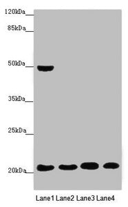 Western blot | All lanes: MOCS2 antibody at 0.47 μg/ml | Lane 1: A549 whole cell lysate | Lane 2: HepG2 whole cell lysate | Lane 3: Jurkat whole cell lysate | Lane 4: Hela whole cell lysate | Secondary | Goat polyclonal to rabbit IgG at 1/10000 dilution | Predicted band size: 21 kDa | Observed band size: 21, 49 kDaRabbit anti-Human MOCS2 Polyclonal Antibody