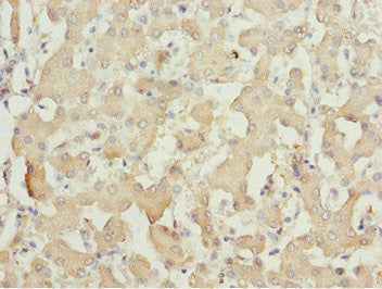 Immunohistochemistry of paraffin-embedded human liver tissue using MOCS3 Antibody at dilution of 1:100Rabbit anti-Human MOCS3 Polyclonal Antibody