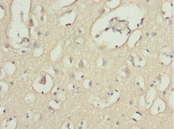 Immunohistochemistry of paraffin-embedded human brain tissue using MOCS3 Antibody at dilution of 1:100Rabbit anti-Human MOCS3 Polyclonal Antibody