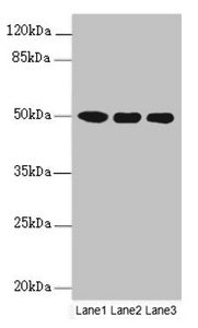 Western blot | All lanes: MOCS3 antibody at 4.25μg/ml | Lane 1: A549 whole cell lysate | Lane 2: HepG2 whole cell lysate | Lane 3: Jurkat whole cell lysate | Secondary | Goat polyclonal to rabbit IgG at 1/10000 dilution | Predicted band size: 50 kDa | Observed band size: 50 kDa