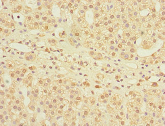 Immunohistochemistry of paraffin-embedded human adrenal gland tissue using MPI Antibody at dilution of 1:100Rabbit anti-Human MPI Polyclonal Antibody
