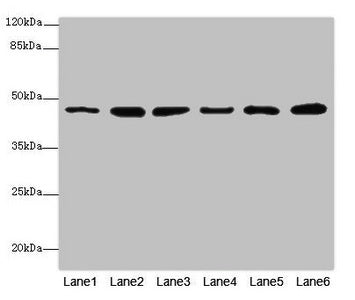 Western blot  | All lanes: MPI antibody at 5.12µg/ml  | Lane 1: Mouse heart tissue  | Lane 2: Mouse kidney tissue  | Lane 3: Mouse brain tissue  | Lane 4: HepG2 whole cell lysate  | Lane 5: 293T whole cell lysate  | Lane 6: A549 whole cell lysate  | Secondary  | Goat polyclonal to rabbit IgG at 1/10000 dilution  | Predicted band size: 47, 40 kDa  | Observed band size: 47 kDa