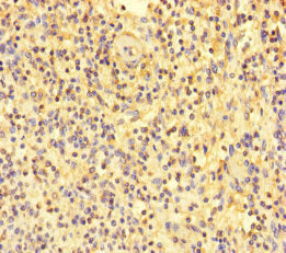 Immunohistochemistry of paraffin-embedded human spleen tissue using MPL Antibody at dilution of 1:100Rabbit anti-Human MPL Polyclonal Antibody