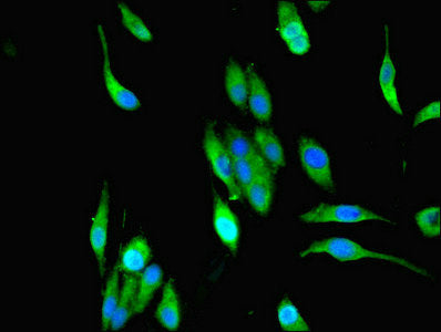 Immunofluorescent analysis of Hela cells using MPPED1 Antibody at dilution of 1:100 and Alexa Fluor 488-congugated AffiniPure Goat Anti-Rabbit IgG(H+L)Rabbit anti-Human MPPED1 Polyclonal Antibody