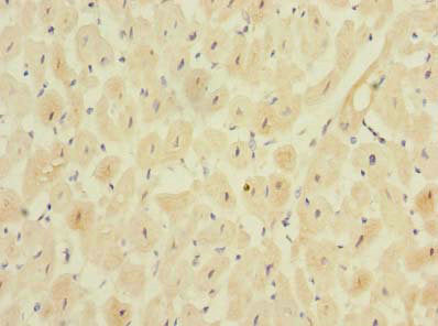 Immunohistochemistry of paraffin-embedded human heart tissue using MPPED1 Antibody at dilution of 1:100Rabbit anti-Human MPPED1 Polyclonal Antibody