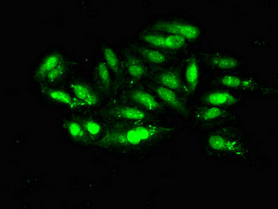 Immunofluorescent analysis of Hela cells using MRE11A Antibody at dilution of 1:100 and Alexa Fluor 488-congugated AffiniPure Goat Anti-Rabbit IgG(H+L)